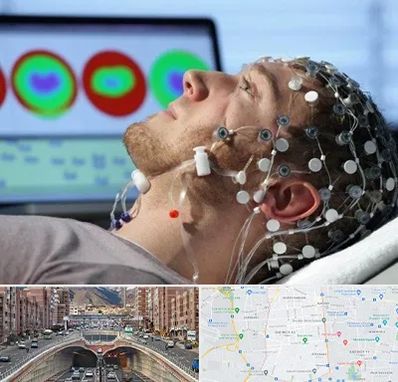 مرکز نوار مغز در منطقه 10 تهران 