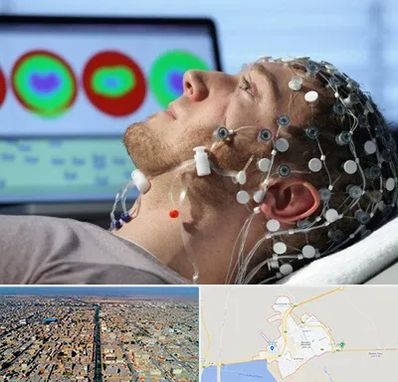 مرکز نوار مغز در بندر ماهشهر