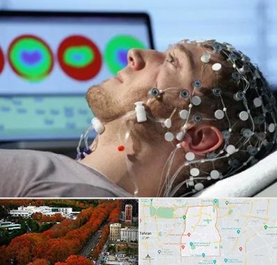 مرکز نوار مغز در منطقه 6 تهران 