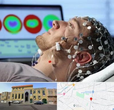 مرکز نوار مغز در زنبیل آباد قم