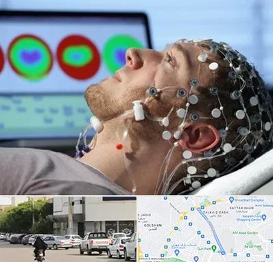 مرکز نوار مغز در قدوسی شرقی شیراز 