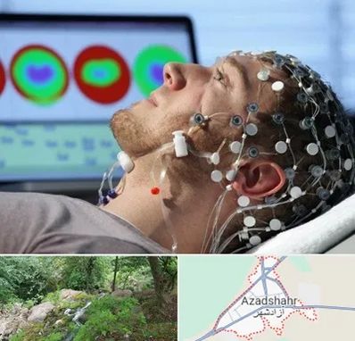 مرکز نوار مغز در آزادشهر