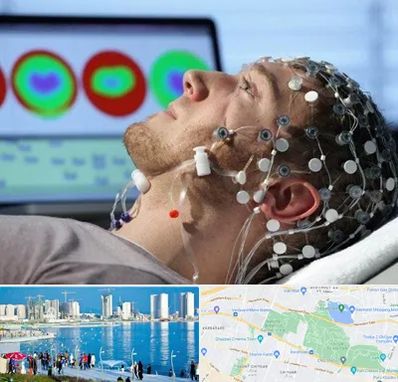 مرکز نوار مغز در چیتگر 