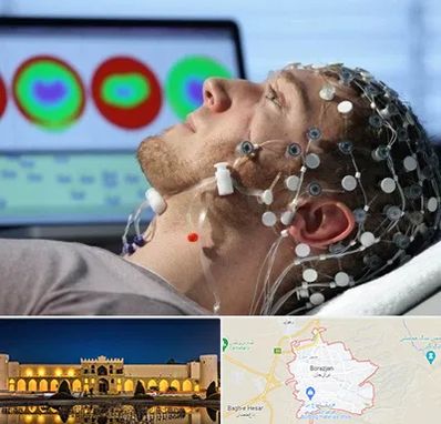 مرکز نوار مغز در برازجان