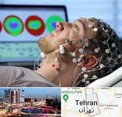 مرکز نوار مغز در صادقیه 