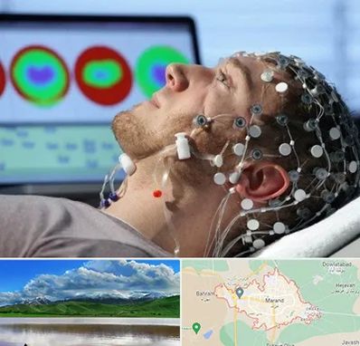 مرکز نوار مغز در مرند