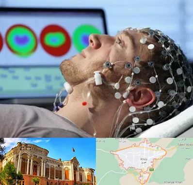 مرکز نوار مغز در خوی