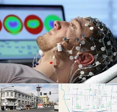 مرکز نوار مغز در 17شهریور