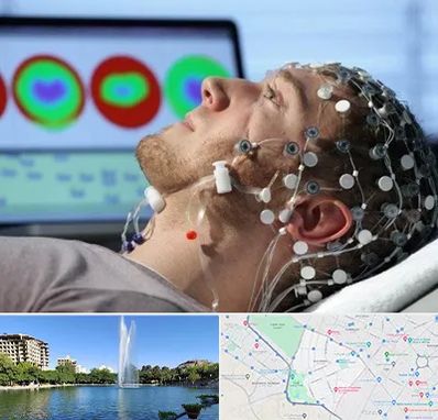 مرکز نوار مغز در کوهسنگی مشهد 