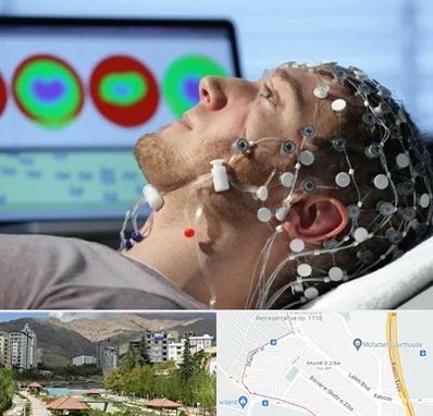 مرکز نوار مغز در شهر زیبا 