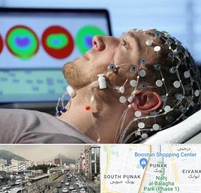 مرکز نوار مغز در پونک 