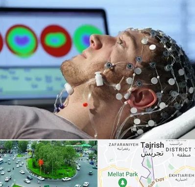 مرکز نوار مغز در تجریش 