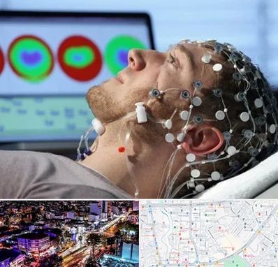 مرکز نوار مغز در منظریه رشت 