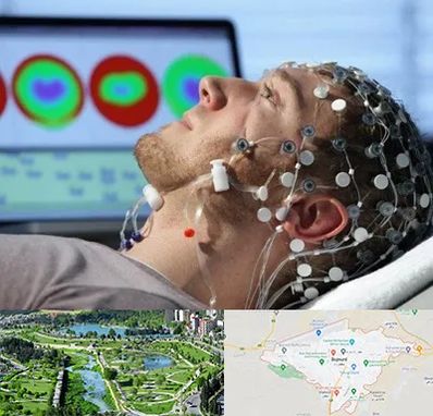 مرکز نوار مغز در بجنورد