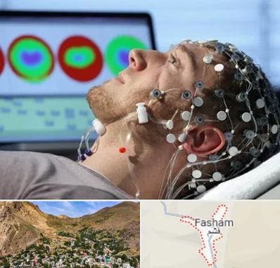 مرکز نوار مغز در فشم