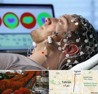 مرکز نوار مغز در ولیعصر 