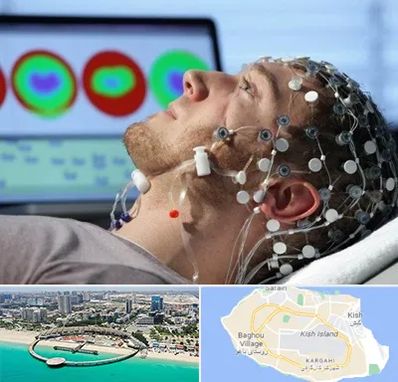 مرکز نوار مغز در کیش