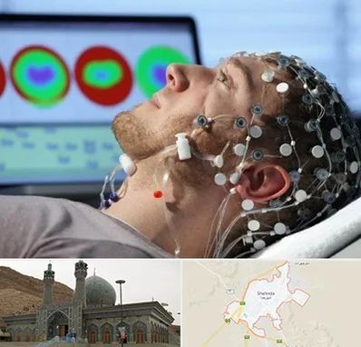 مرکز نوار مغز در شهرضا