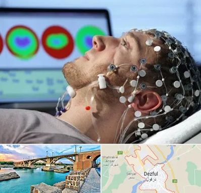 مرکز نوار مغز در دزفول