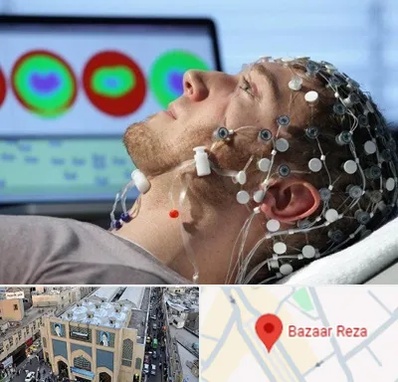 مرکز نوار مغز در بازار رضا مشهد