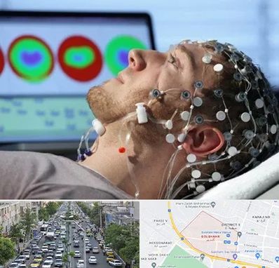 مرکز نوار مغز در گلشهر کرج 