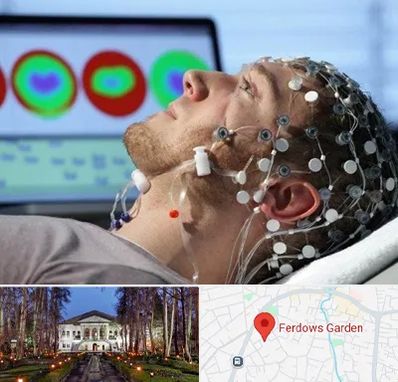 مرکز نوار مغز در باغ فردوس