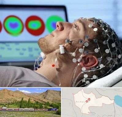 مرکز نوار مغز در خاش