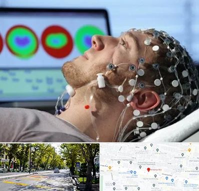 مرکز نوار مغز در میرداماد 