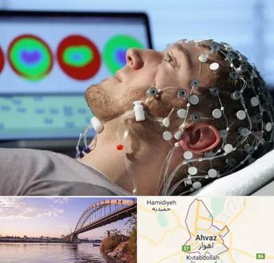 مرکز نوار مغز در اهواز