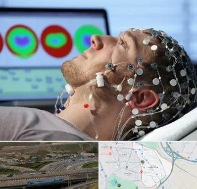 مرکز نوار مغز در یاغچیان تبریز