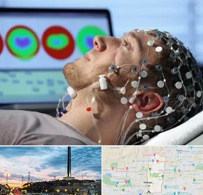 مرکز نوار مغز در منطقه 2 تهران 