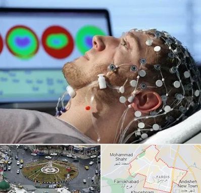 مرکز نوار مغز در فردیس کرج 