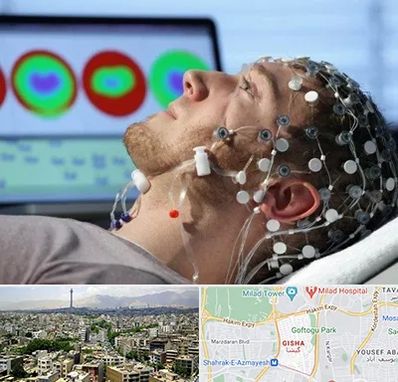 مرکز نوار مغز در گیشا 