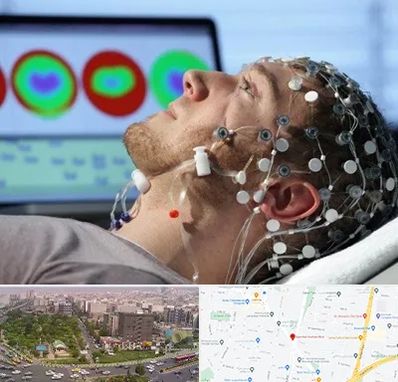 مرکز نوار مغز در آیت الله کاشانی 