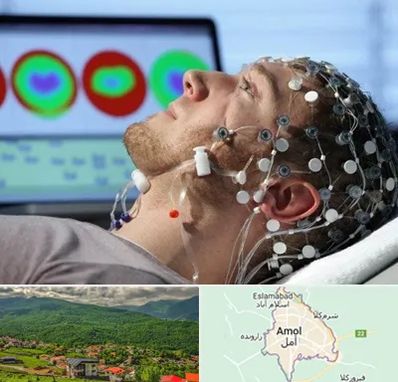 مرکز نوار مغز در آمل