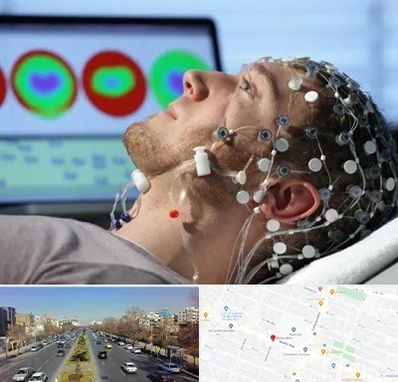 مرکز نوار مغز در بلوار معلم مشهد 