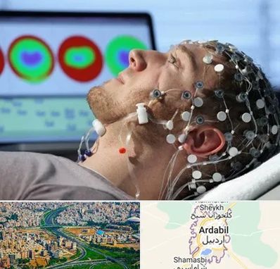 مرکز نوار مغز در اردبیل