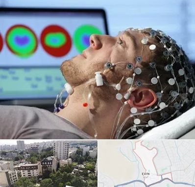 مرکز نوار مغز در اوین