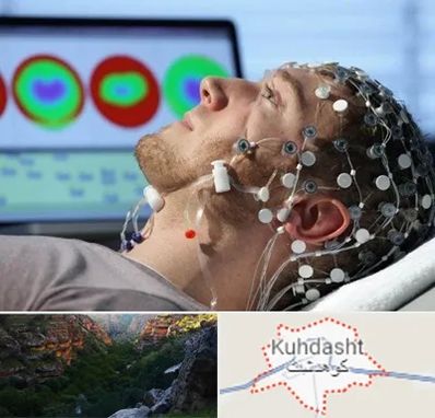 مرکز نوار مغز در کوهدشت