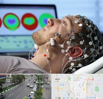 مرکز نوار مغز در ستارخان 