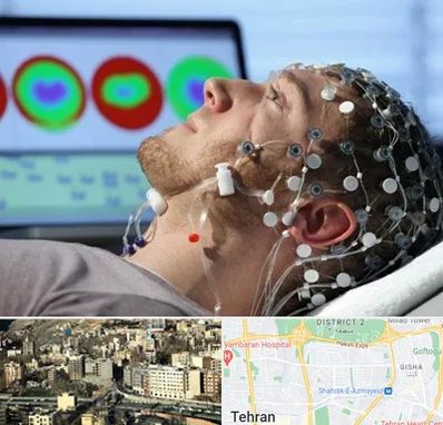 مرکز نوار مغز در مرزداران 