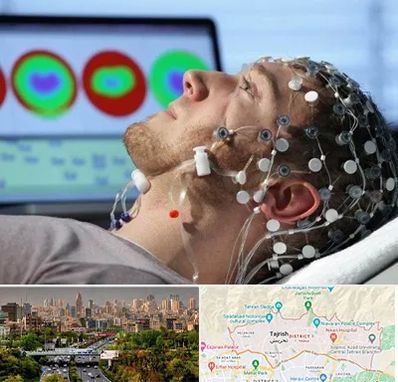 مرکز نوار مغز در منطقه 1 تهران 