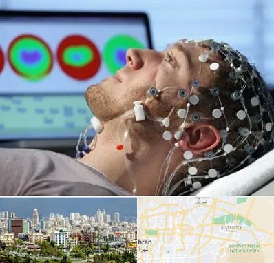 مرکز نوار مغز در شرق تهران 