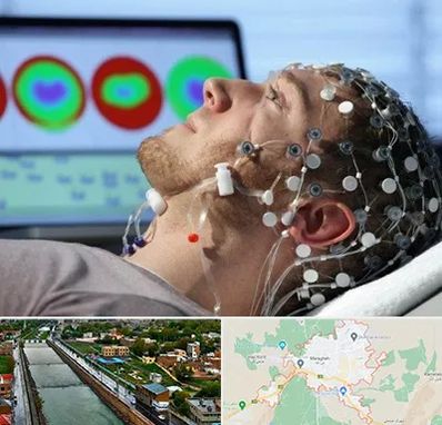 مرکز نوار مغز در مراغه