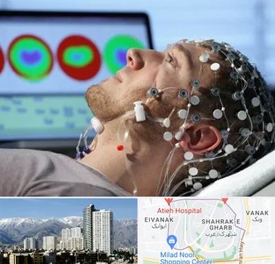 مرکز نوار مغز در شهرک غرب 