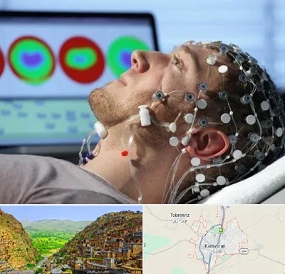 مرکز نوار مغز در کامیاران