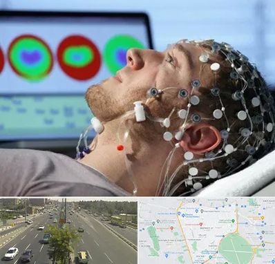 مرکز نوار مغز در منطقه 17 تهران 