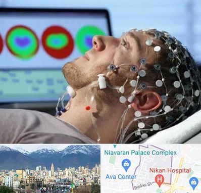 مرکز نوار مغز در آجودانیه 