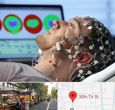 مرکز نوار مغز در سی تیر
