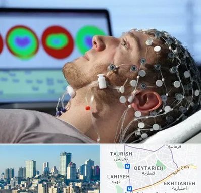 مرکز نوار مغز در قیطریه 